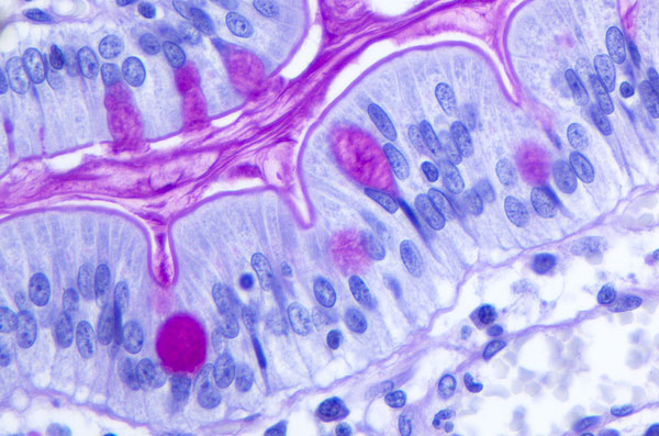 qualipath-standardfaerbungen-histochemische-faerbungen-6b Qualipath: Standardfärbungen, histochemische Färbungen