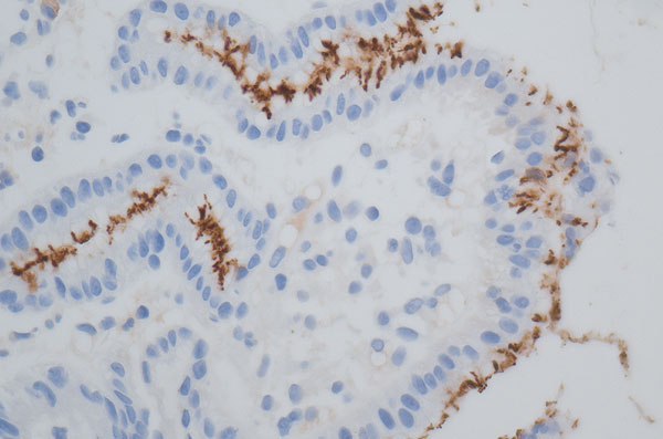 Qualipath: Immunhistochemische Färbungen
