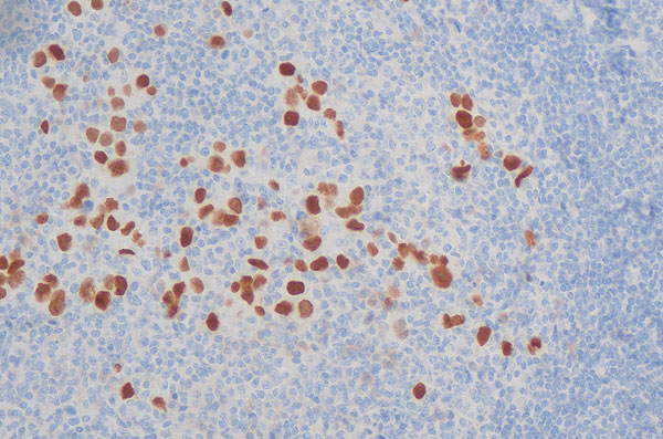 Qualipath: Immunhistochemische Färbungen
