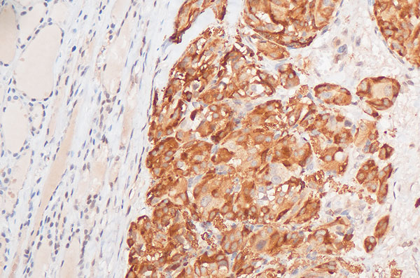 Qualipath: Immunhistochemische Färbungen
