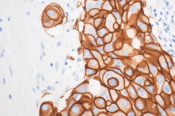 Qualipath: Immunhistochemische Färbungen