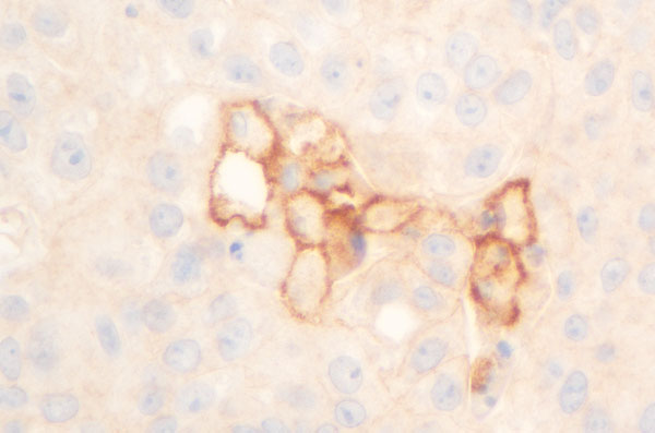 Qualipath: Immunhistochemische Färbungen