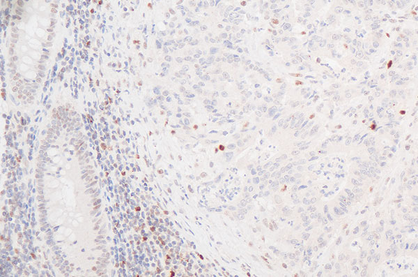 Qualipath: Immunhistochemische Färbungen