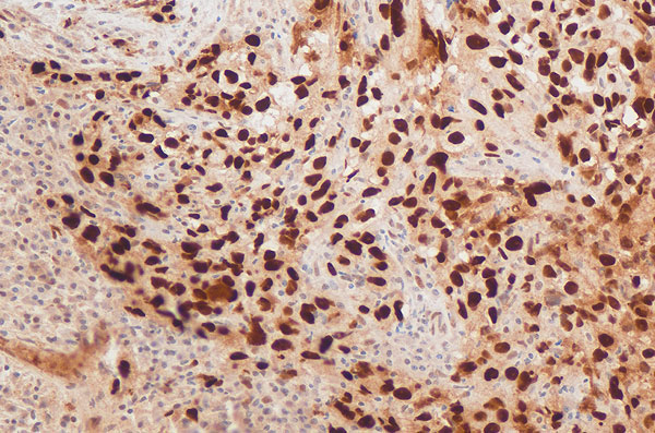 Qualipath: Immunhistochemische Färbungen