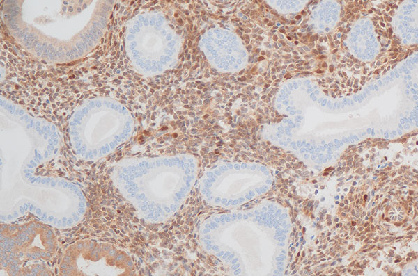 Qualipath: Immunhistochemische Färbungen